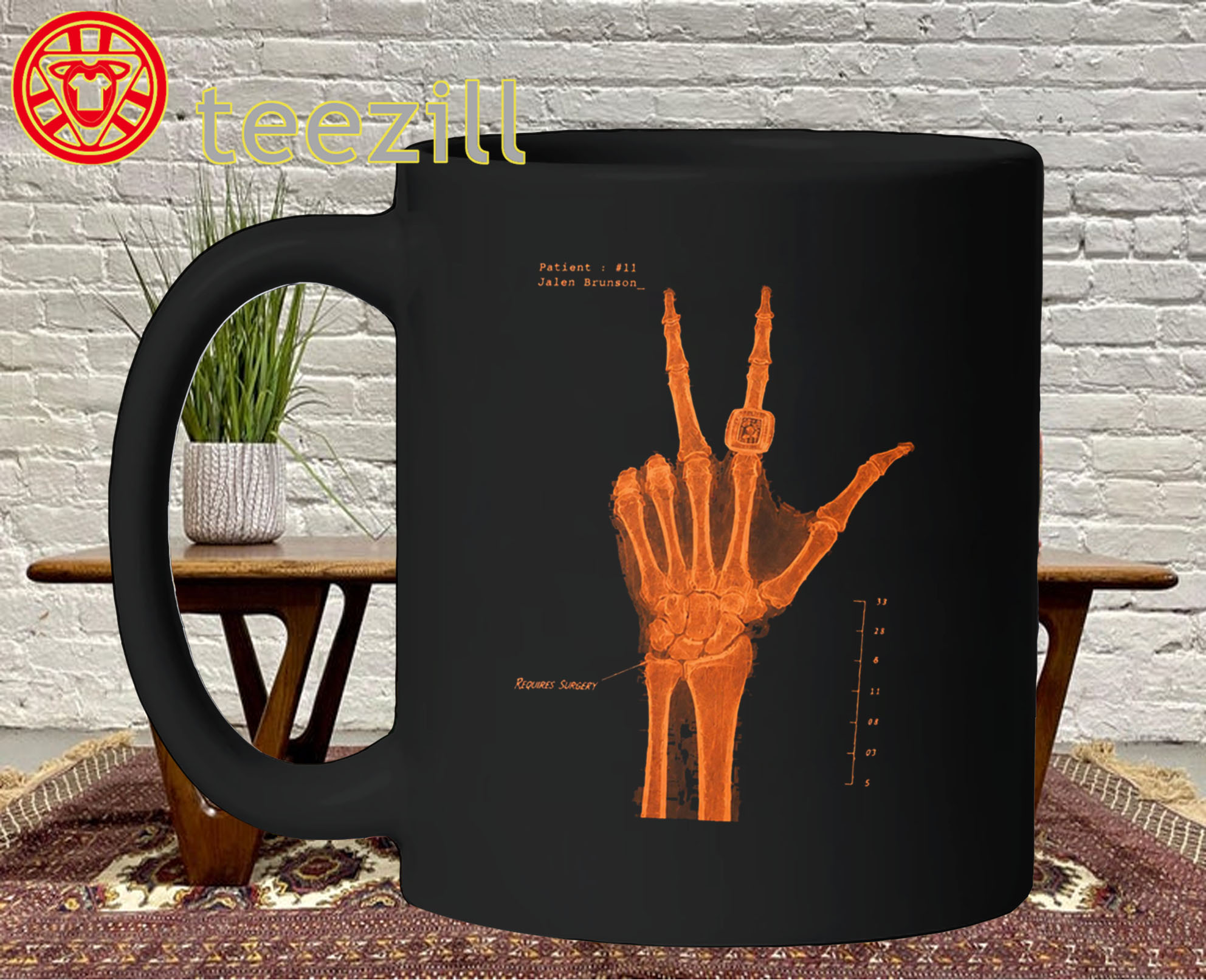 Jalen Brunson Hand X-Ray Mug